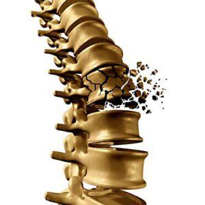 Spinal Injury Lawyer