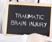 Traumatic Brain Injury Lawyer Attorney In Virginia